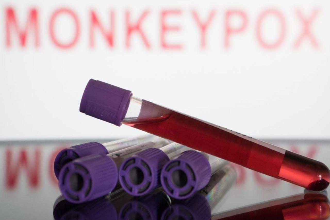 Da testagem ao resultado, conheça como é feito o diagnóstico da varíola dos macacos